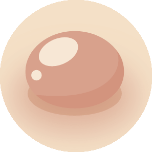 Verruca Plana, Wart